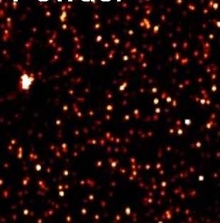 alpha-synuclein aggregates from Parkinson’s brain