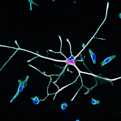 A human astrocyte in culture