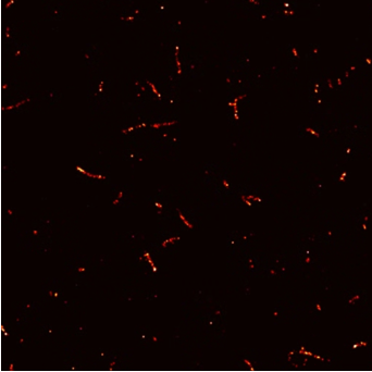 Tiny clumps of tau protein, known as aggregates, visualised using super-resolution microscopy to reveal their different sizes and shapes