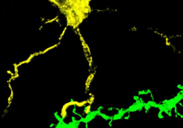 Confocal microscopy of a microglia interacting with dendritic spines