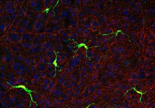 A fluorescence microscopy image of brain tissue showing green-labeled microglia with branching processes against a background of red and blue stained cellular structures.