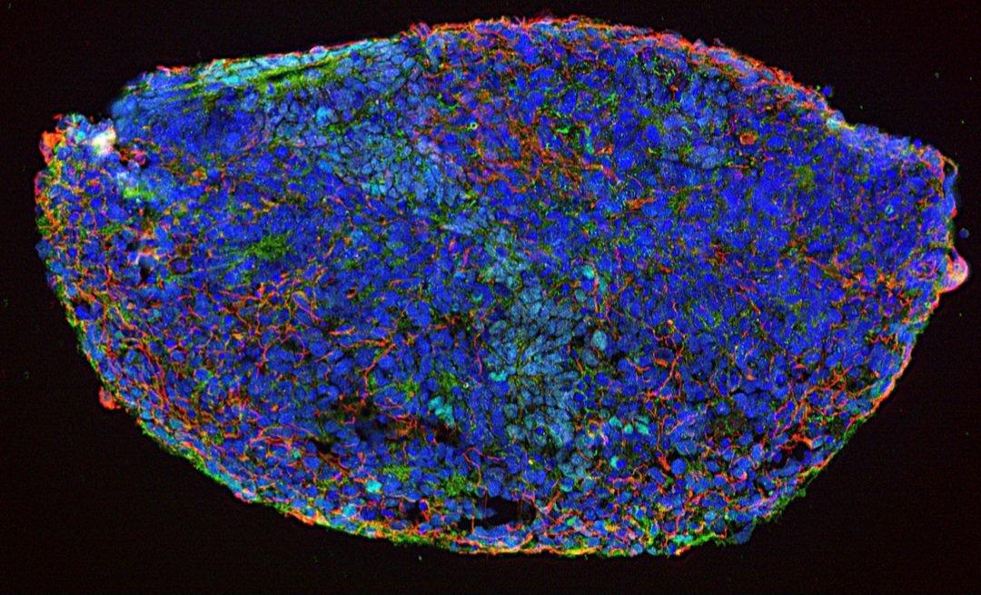 Bowles lab immunofluorescence image