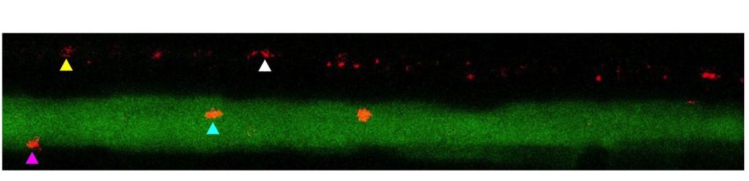 Tracking transport along motor neurons