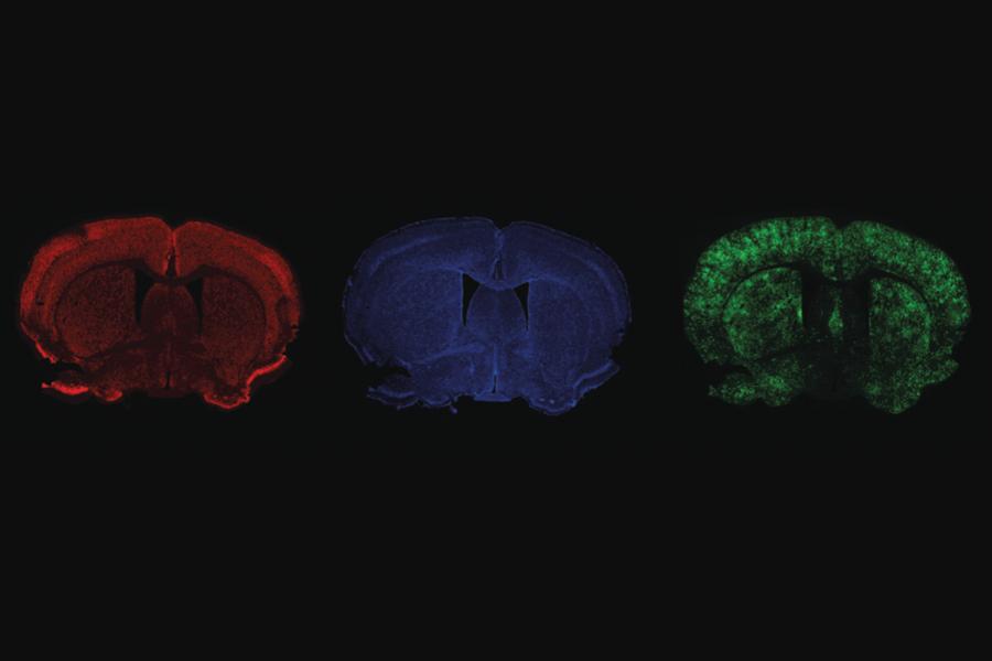 Fluorescence to label different cells and structures of a brain