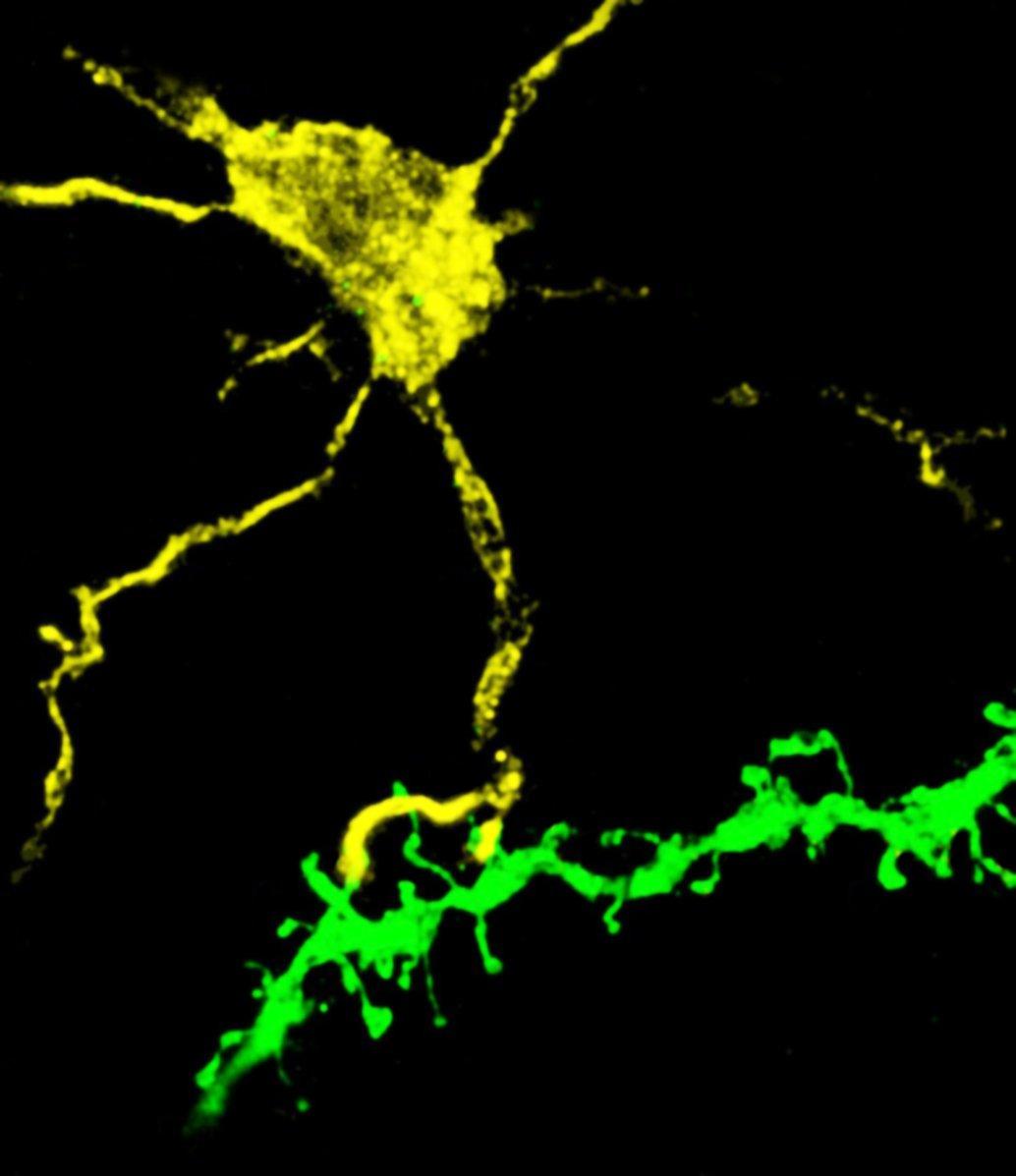 Confocal microscopy of a microglia interacting with dendritic spines