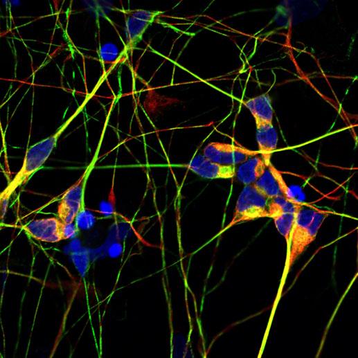 iPSC neurons under a microscope