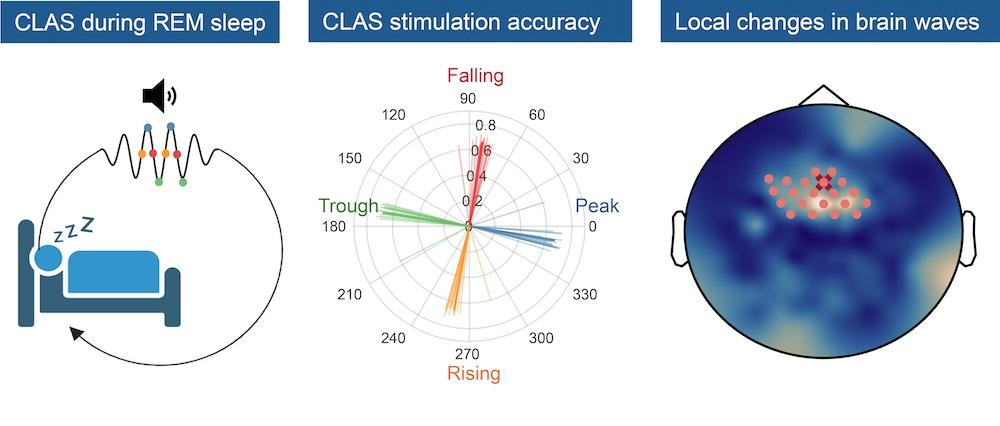 Closed-loop auditory stimulation (CLAS) approach to modulate brain oscillations during REM sleep