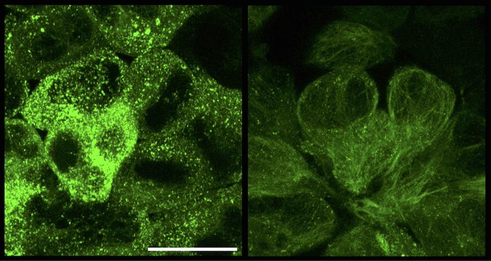 Cells containing tau aggregates (green) before (left) and 13 hours after treatment with RING-nanobody (right)