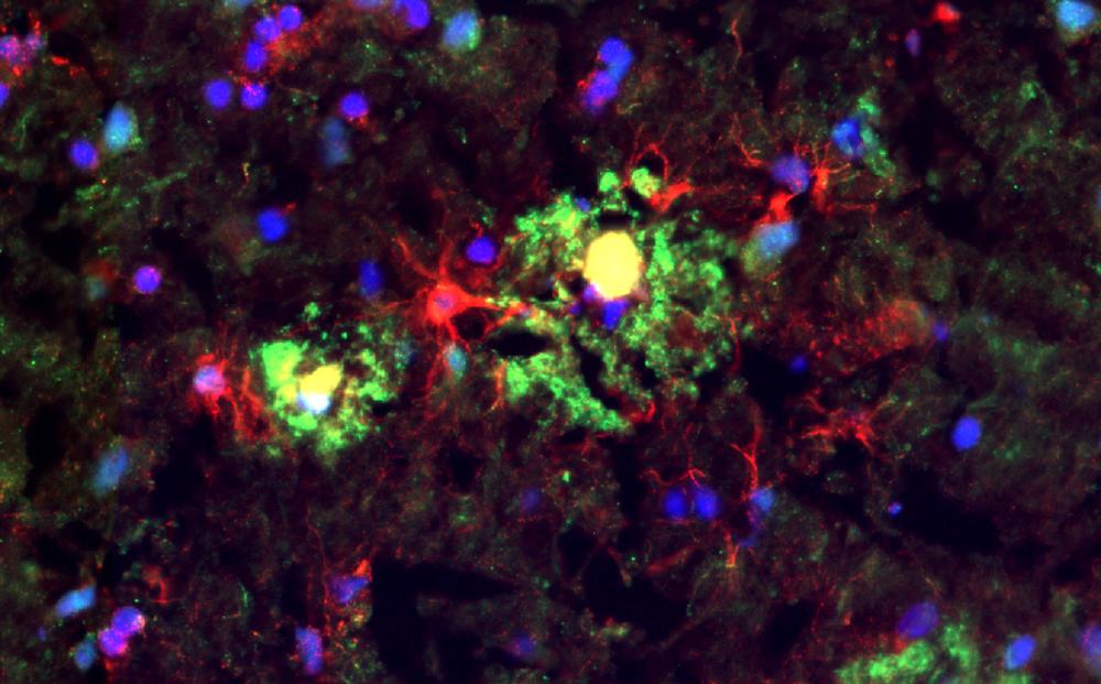 Microglia and astrocyte cells