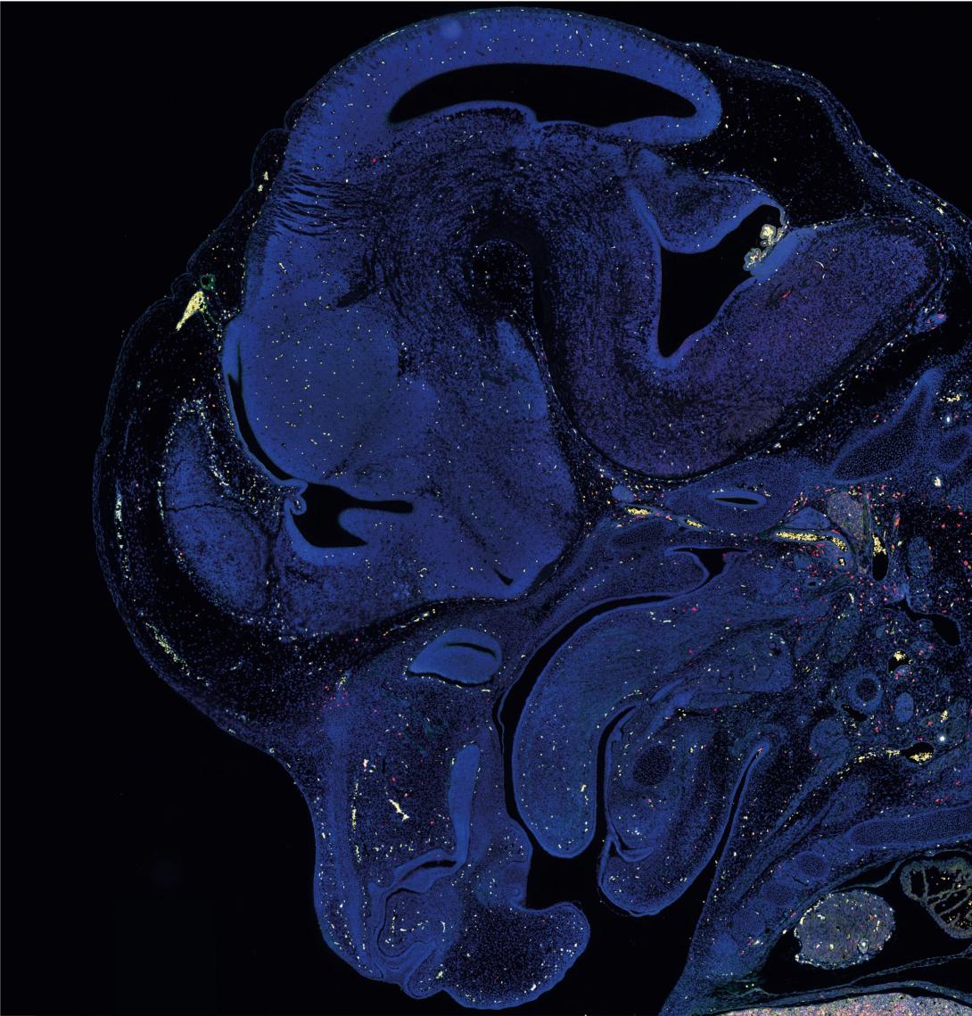 A slice of brain tissue stained with a blue marker