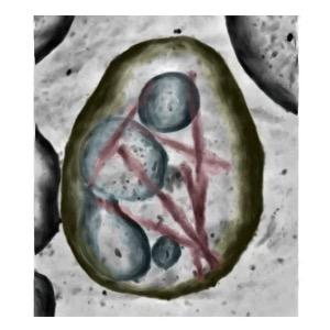 Cryo-ET of a brain extracellular vesicle 