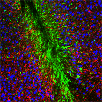 traumatic brain injury in mice
