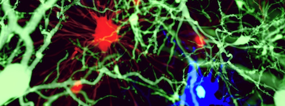 3 Types Of Brain Cell Juan Gaertner Shutterstock