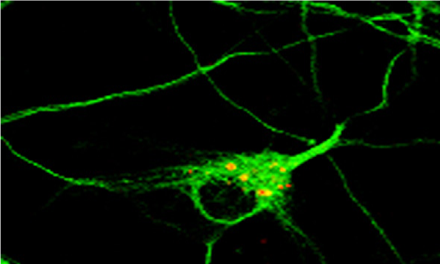 David R Autophagosomes In A Neuron In Primary Culture