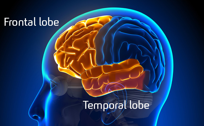 Frontal Temporal Lobe