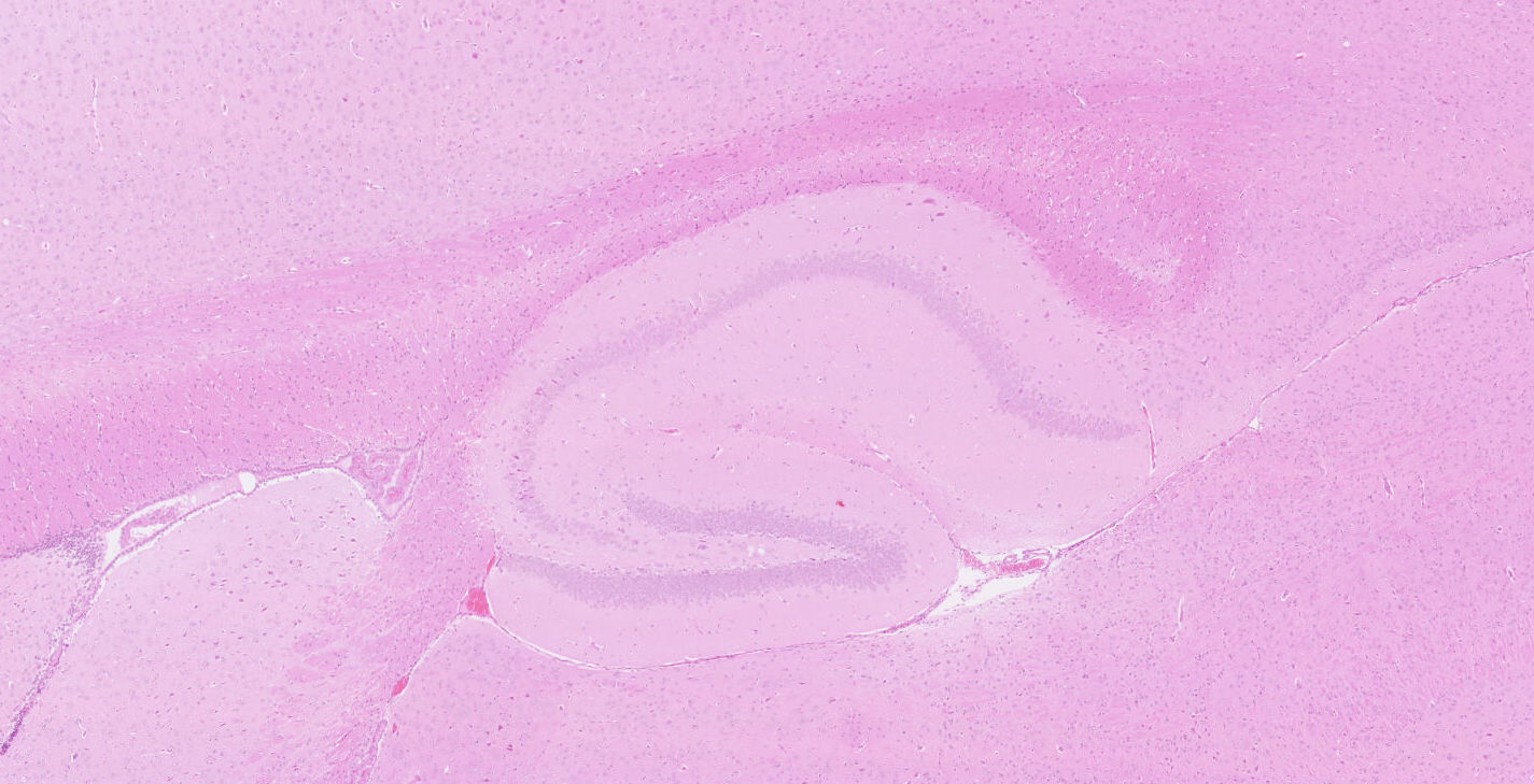 Healthy Mouse Hippocampus