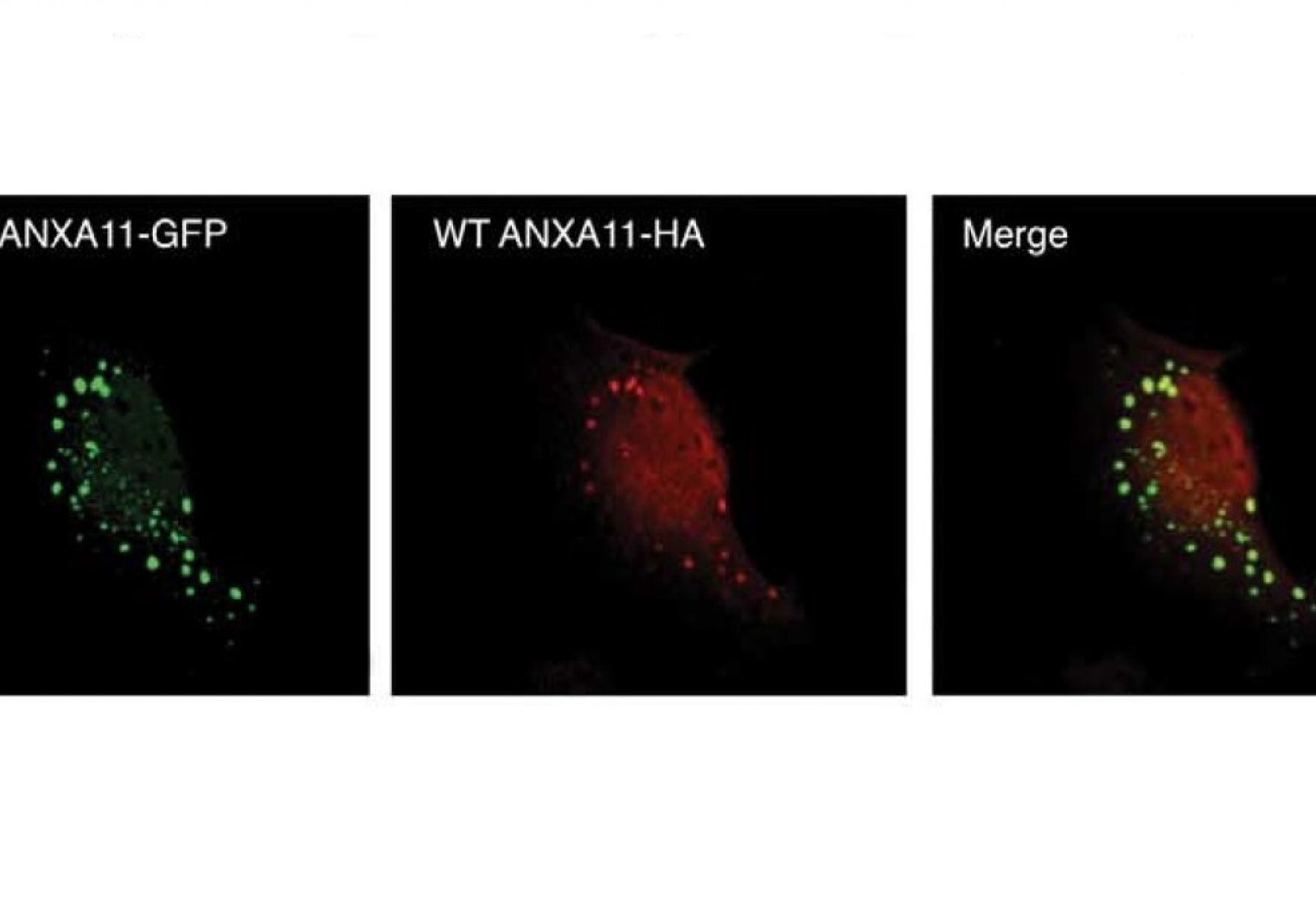 Annexin Final Vesicle Row Large Boreder