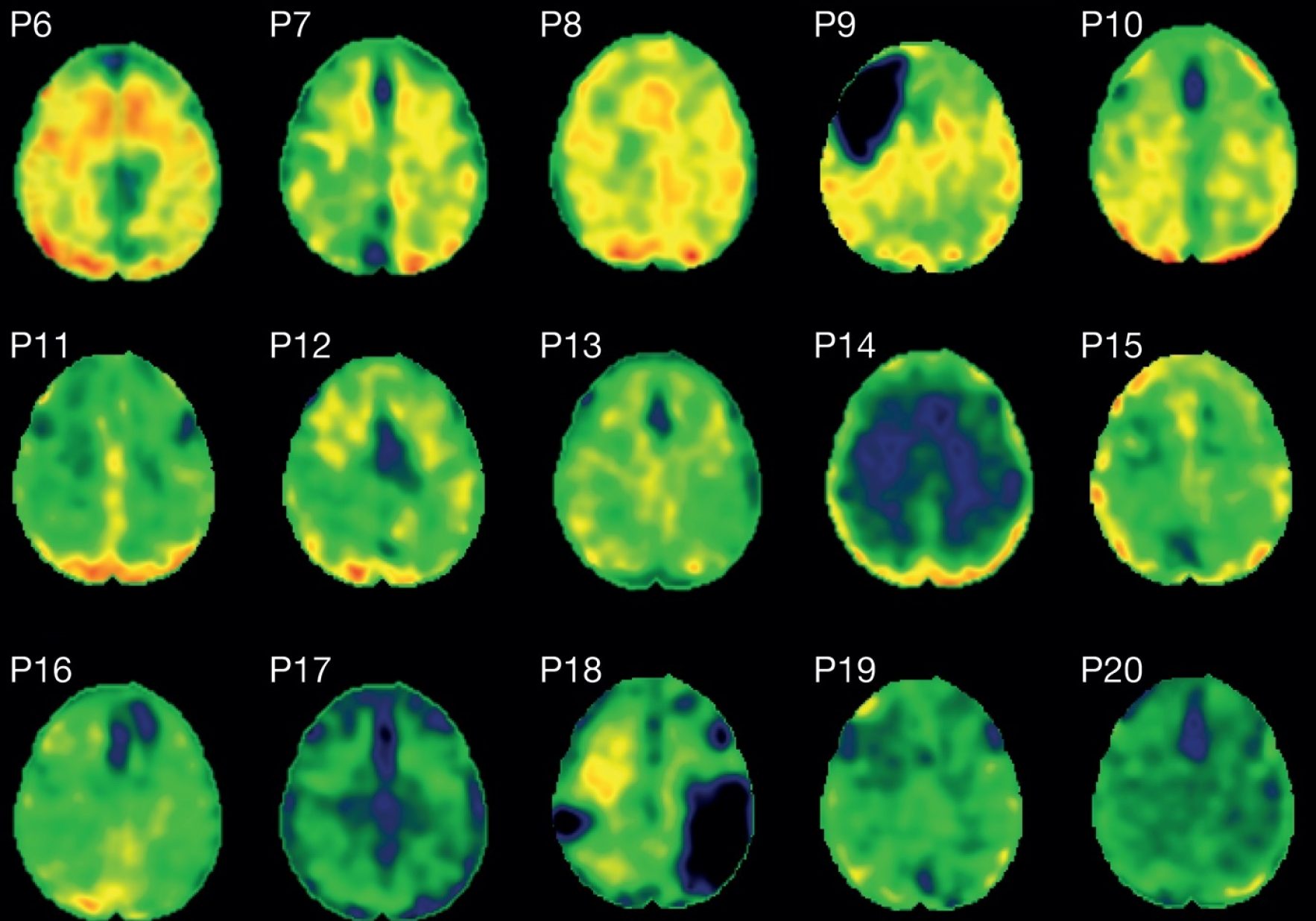 Brain Scans Image