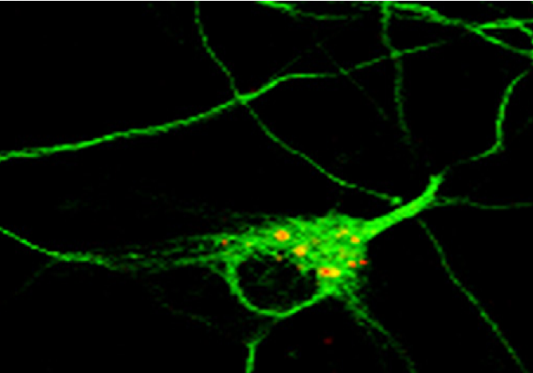 David R Autophagosomes In A Neuron In Primary Culture