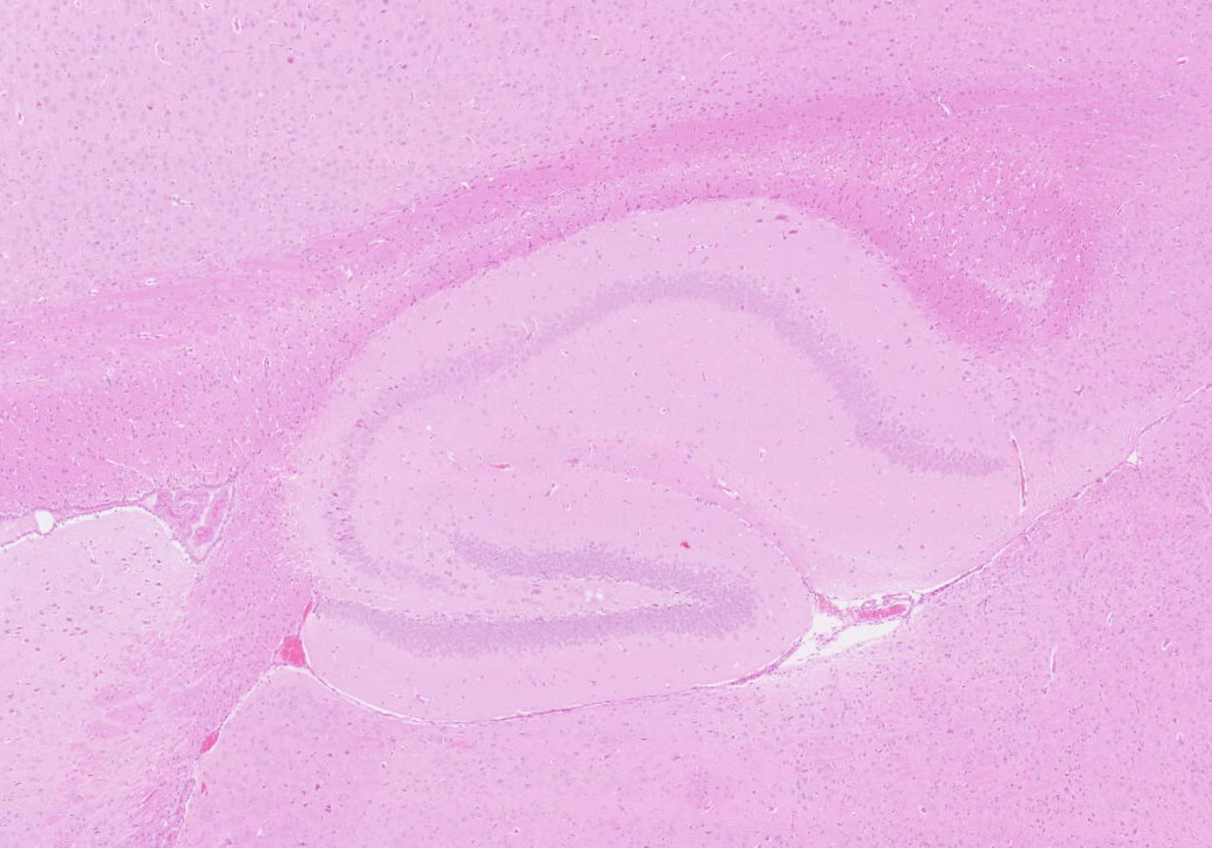 Healthy Mouse Hippocampus