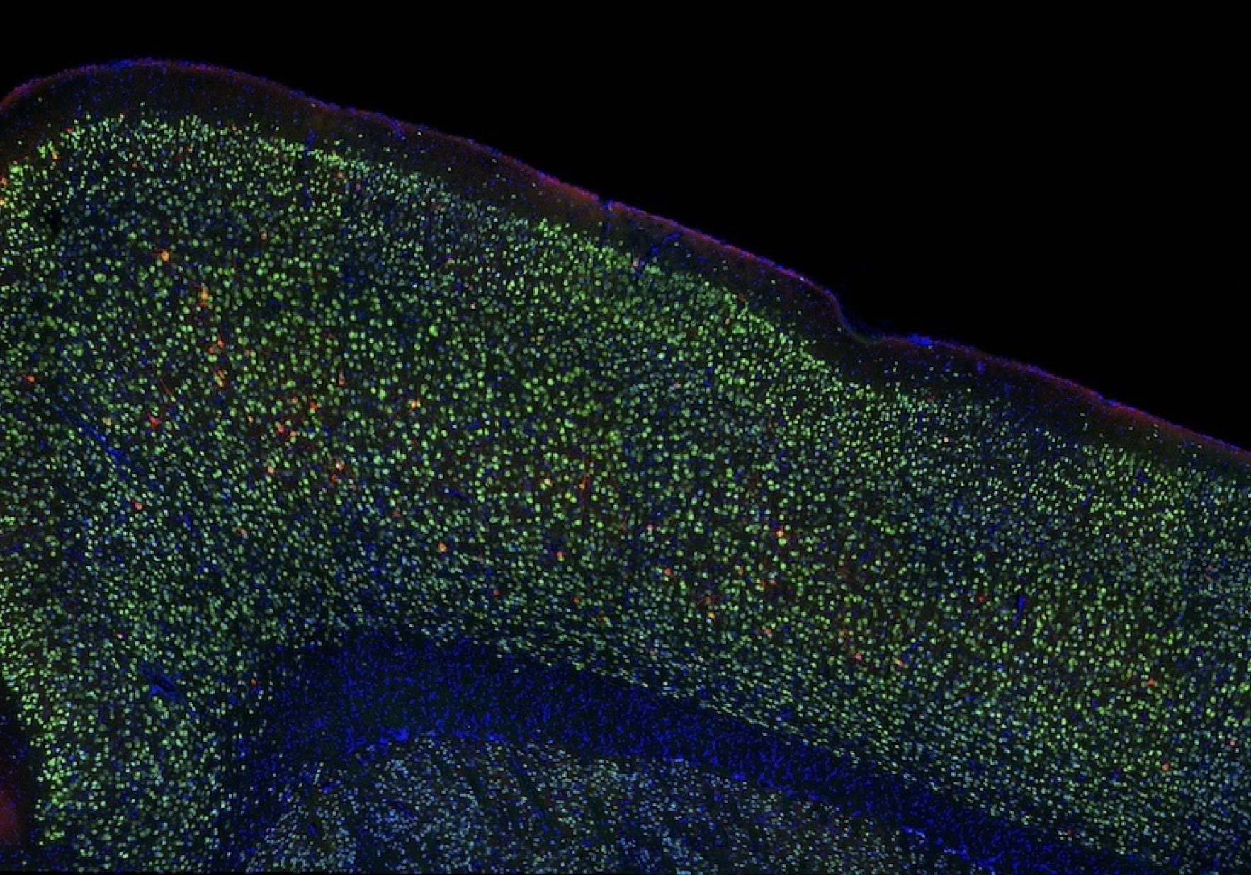 Lmb Dri Neurons Tau Aggregates 2