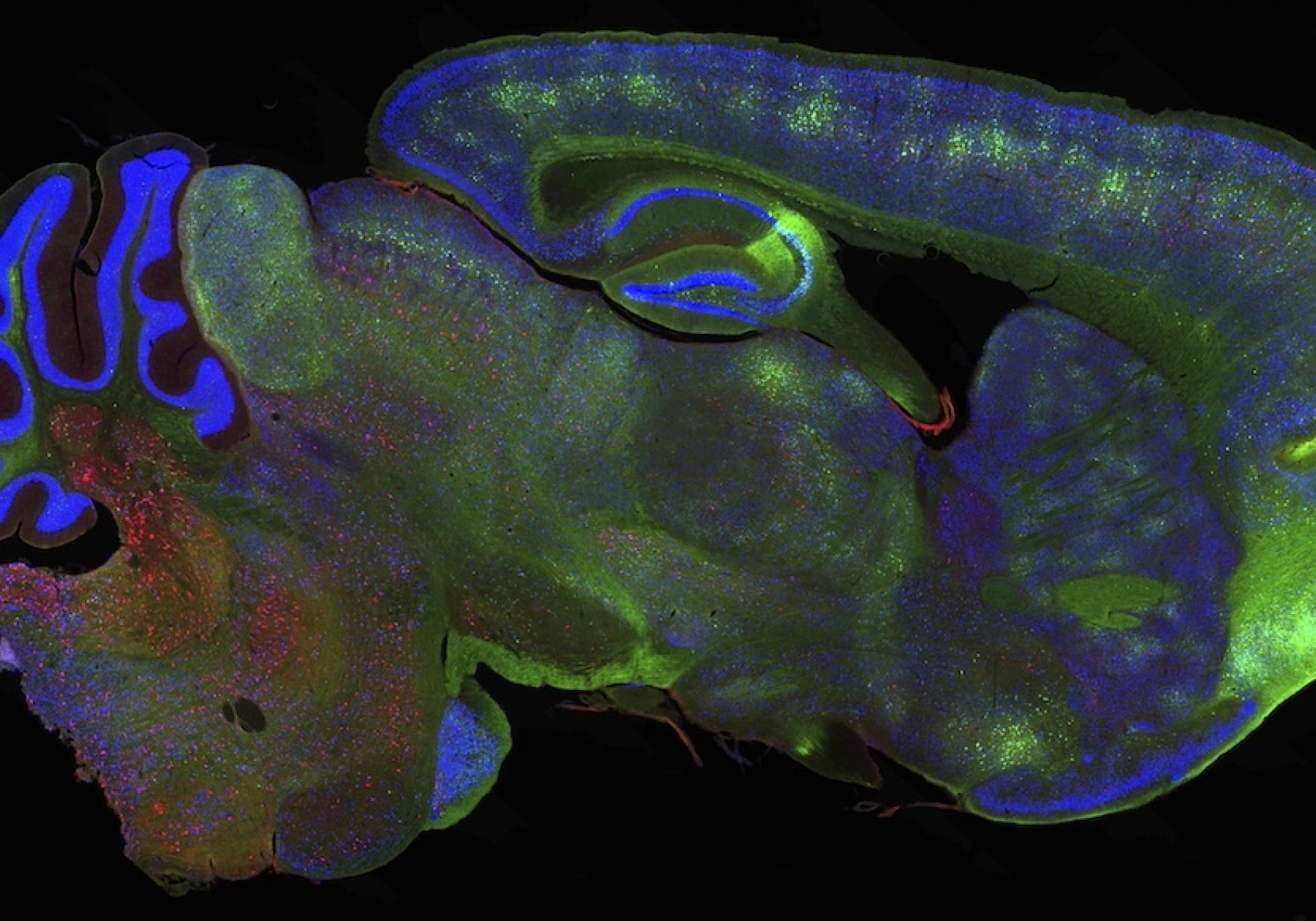 Lmb Dri Tau Therapy Mouse Brain 2 © Mrc Lmb