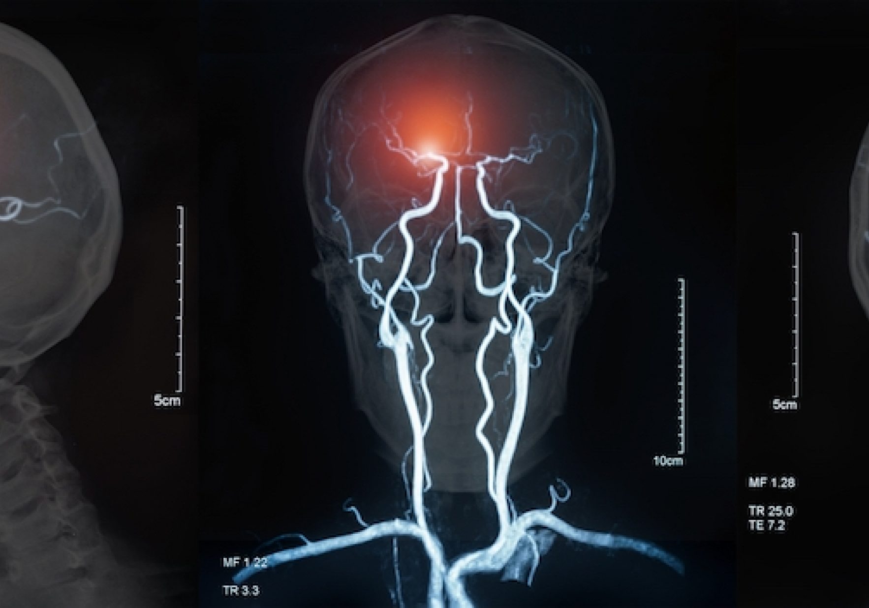 Mri Stroke Shutterstock Create Jobs 51