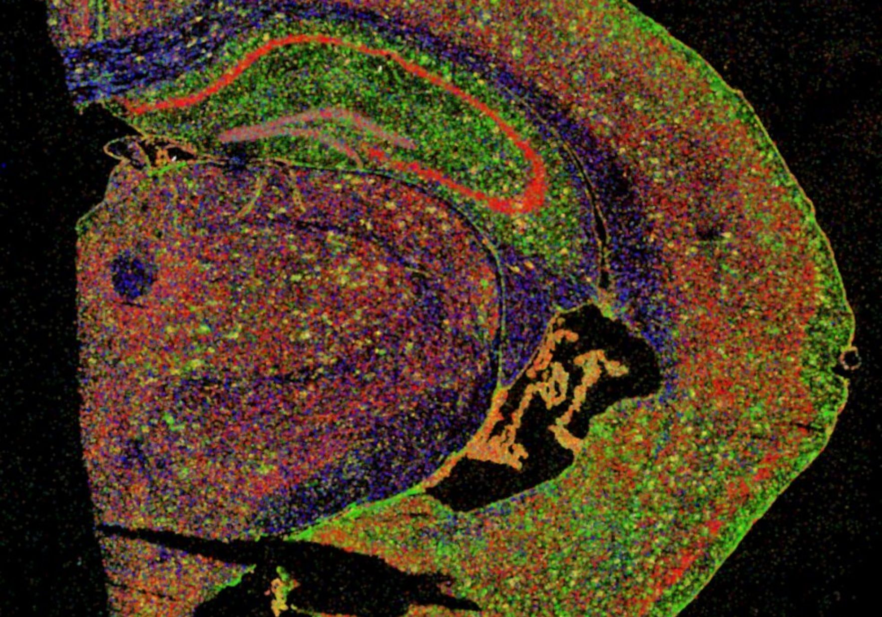 Web Section Of Half A Mouse Brain In Which Different Types Of Brain Cells Are Stained