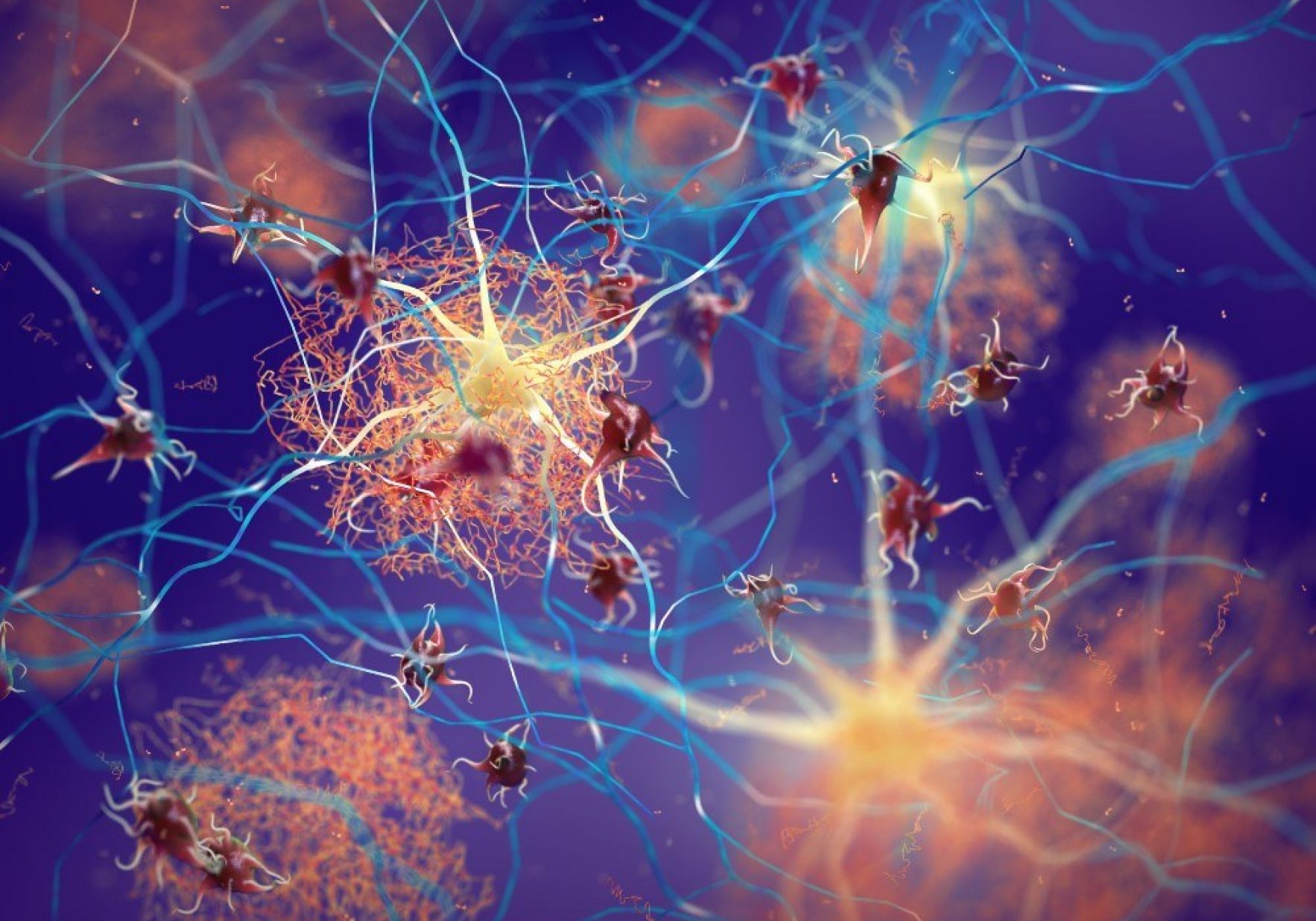 Neurons And Plaques Nobeastsofierce Shutterstock Red