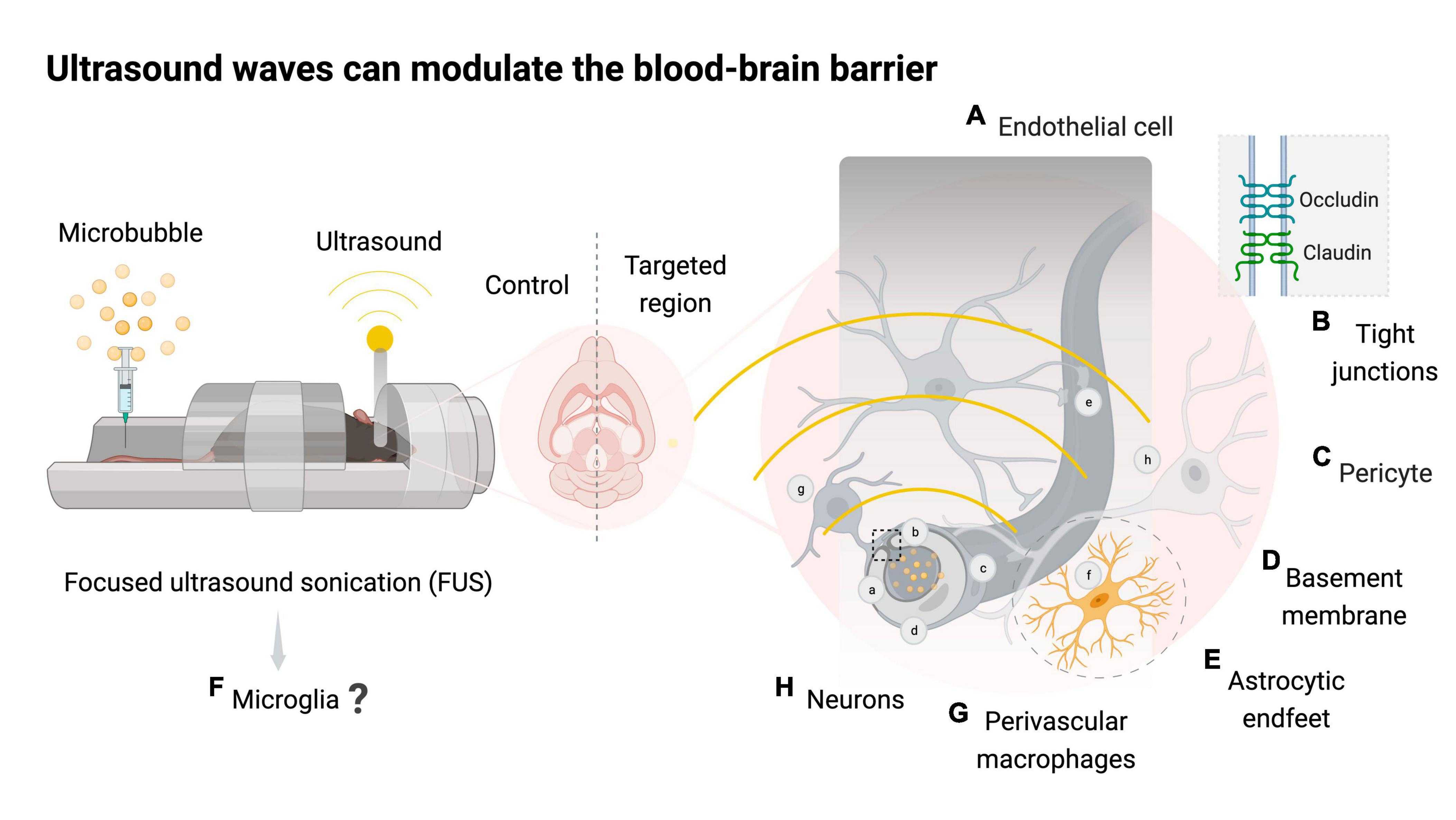 Ultrasound Bbb